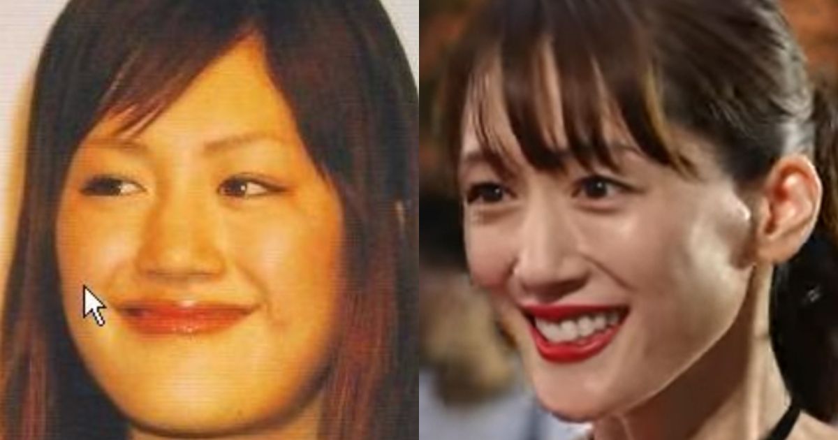 2001年と2025年現在の綾瀬はるかの顔の大きさ比較画像