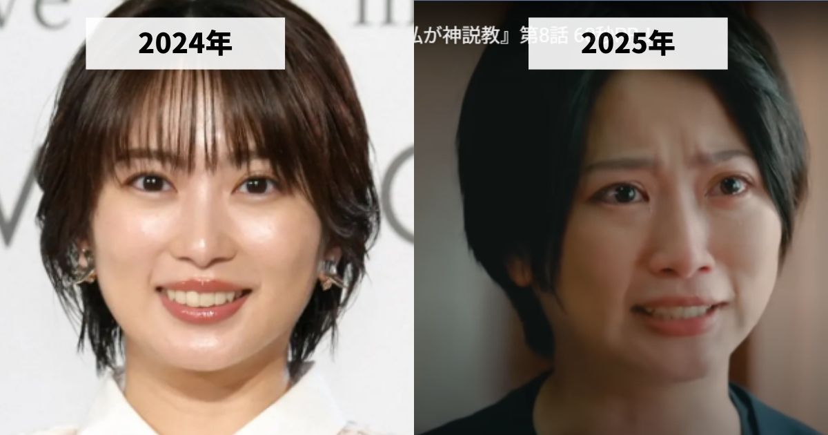 2024年と2025年の志田未来の顔の比較画像