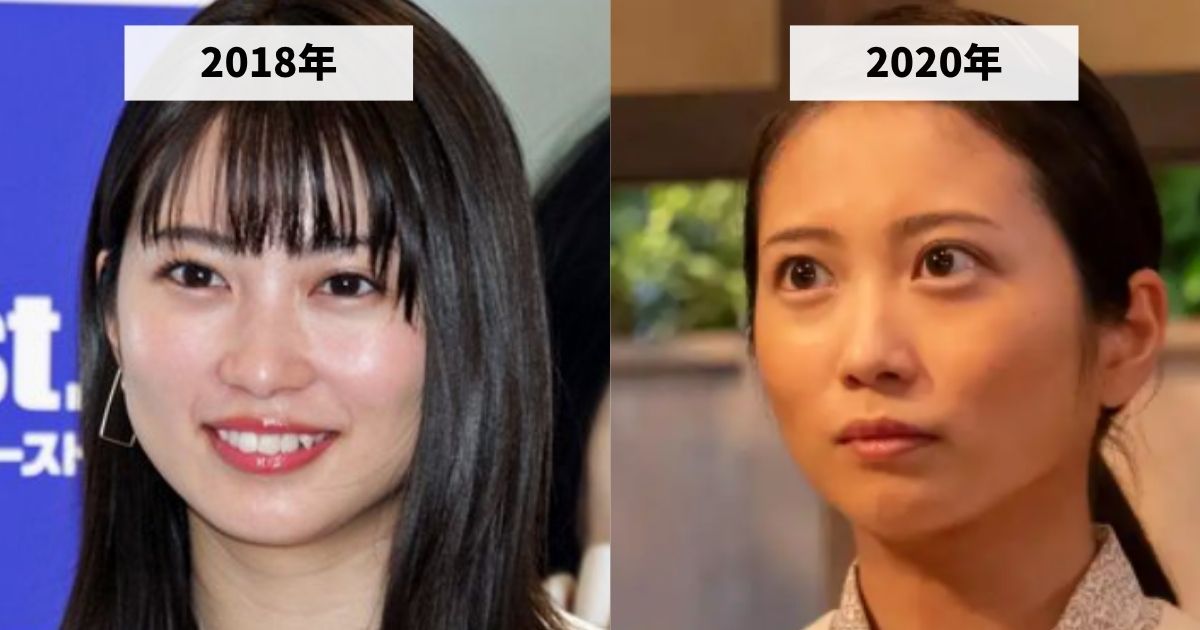 2018年と2020年の志田未来の顔の比較画像
