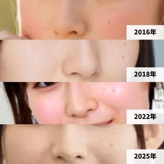 2016年、2018年～2025年までの、白石聖の鼻の変化画像