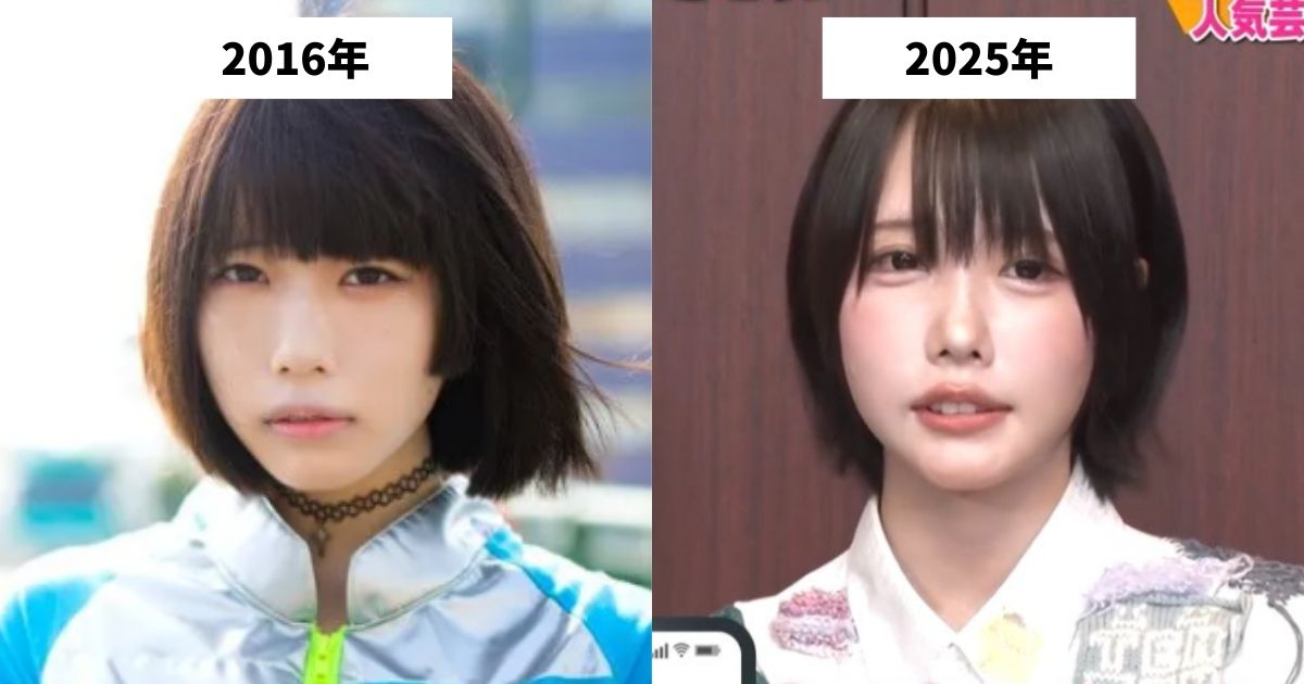2016年と2025年のあのちゃんの顔の比較画像