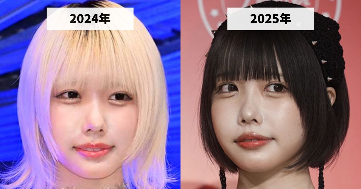 2024年と2025年のあのちゃんの涙袋の変化を比較する画像
