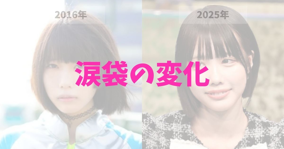 あのちゃんの涙袋はいつから大きくなったのか、ヒアルロン酸注入の整形かメイクかどっち？の記事