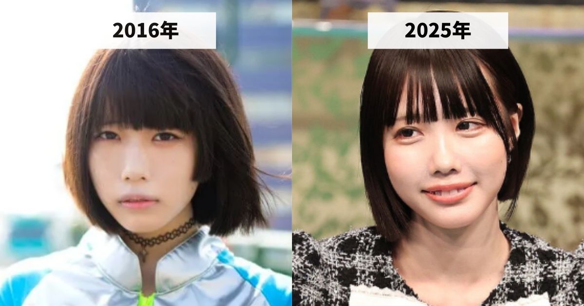 2016年と2025年のあのちゃんの涙袋の変化を比較した画像