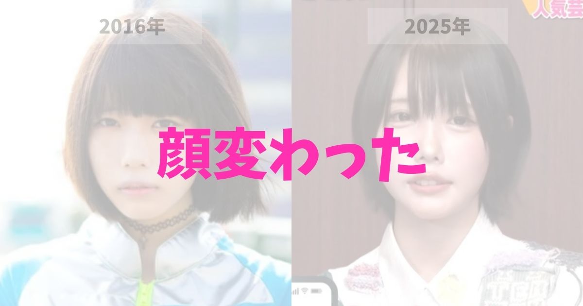 あのちゃんの顔が変わったのは整形？の記事