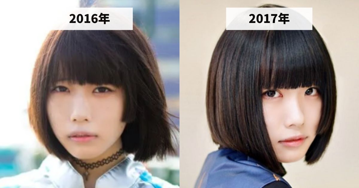 2016年と2017年のあのちゃんの涙袋の変化を比較する画像