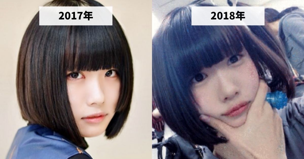 2017年と2018年のあのちゃんの涙袋の変化を比較する画像