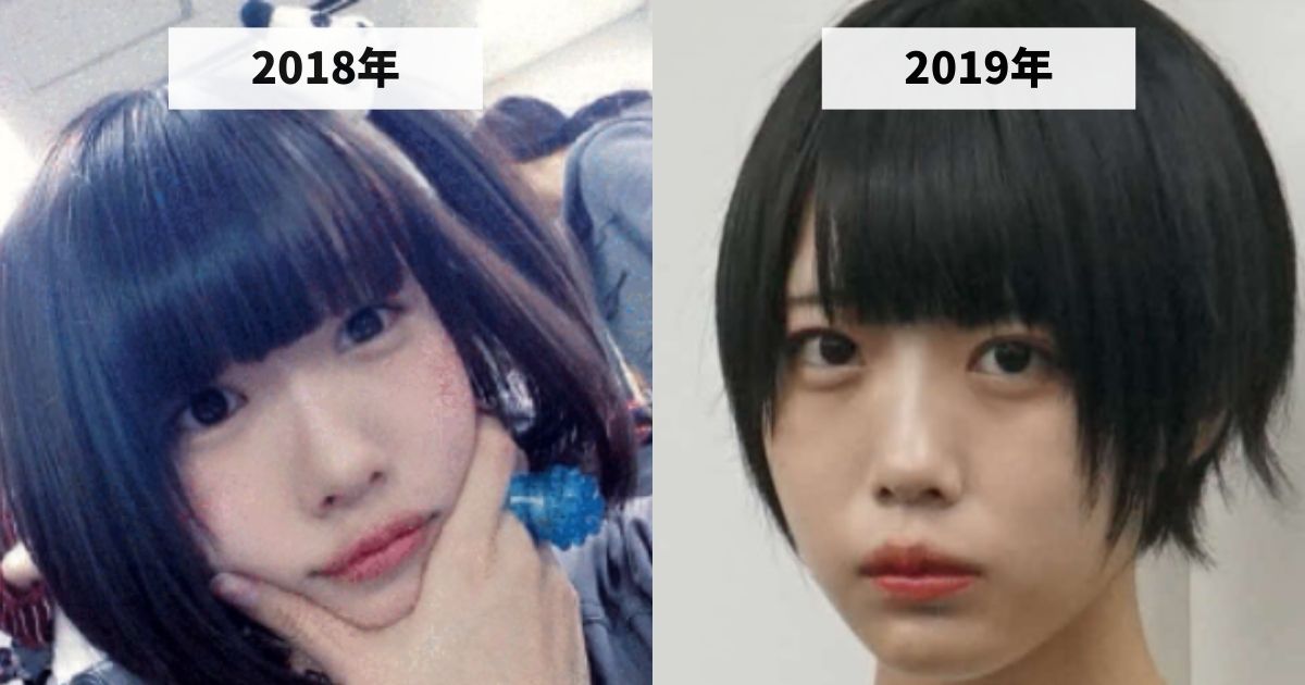 2018年と2019年のあのちゃんの涙袋の変化を比較する画像