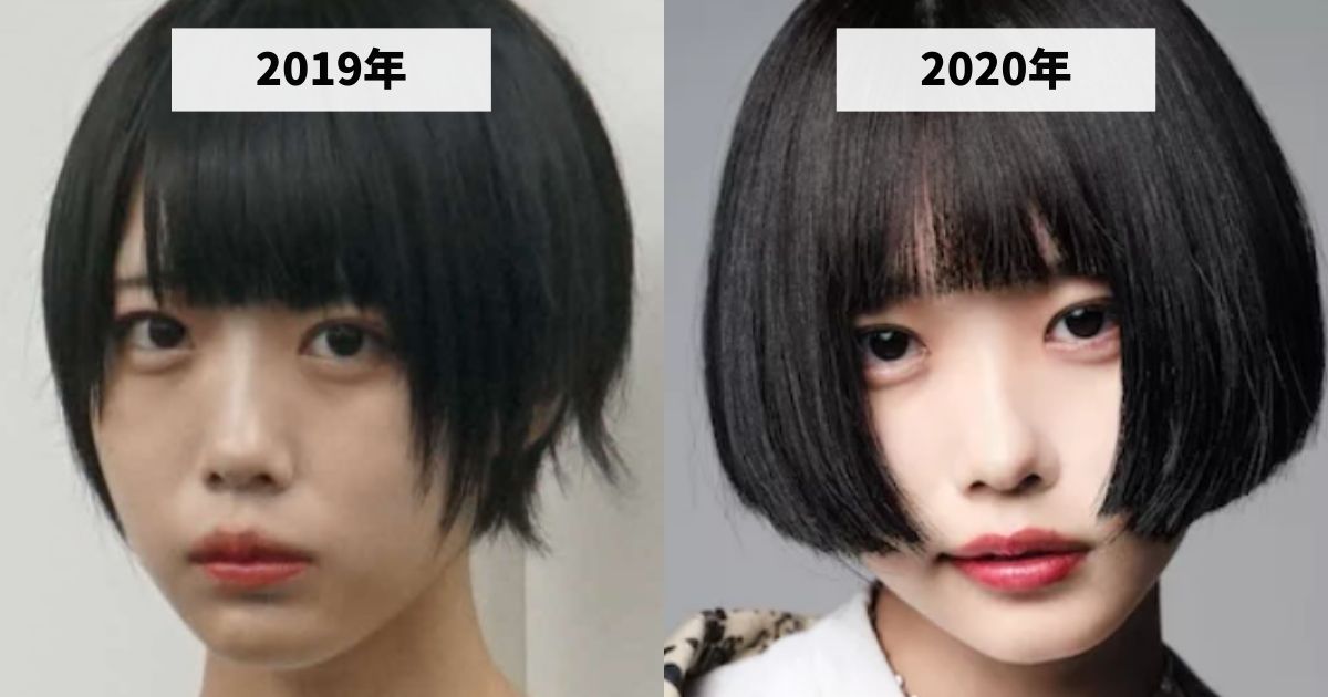 2019年と2020年のあのちゃんの涙袋の変化を比較する画像
