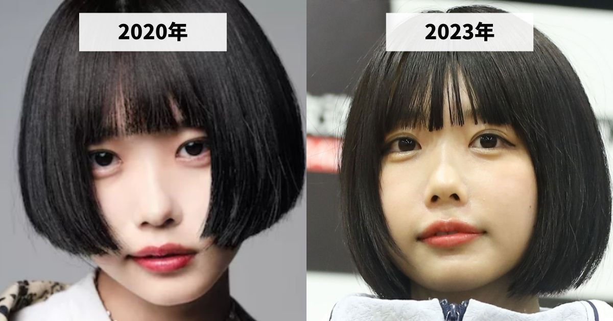 2020年と2023年のあのちゃんの涙袋の変化を比較する画像