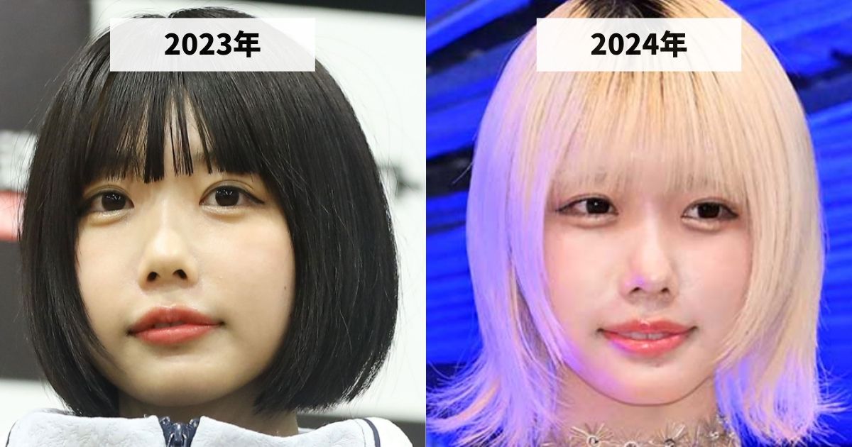 2023年と2024年のあのちゃんの涙袋の変化を比較する画像