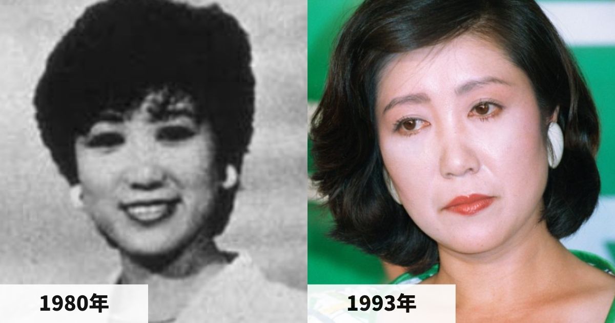 1980年と1993年の小池百合子都知事の顔の比較画像