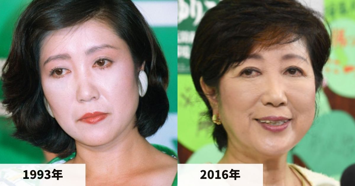 1993年と2016年の小池百合子都知事の顔の比較画像