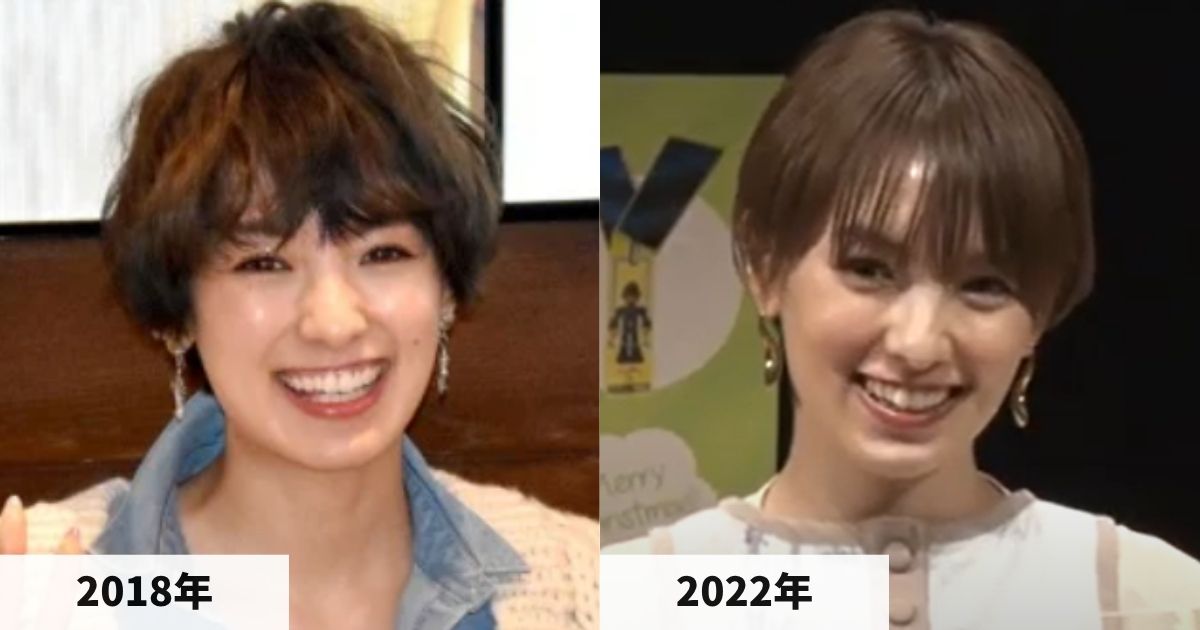 2018年と2022年の南明奈さんの顔の大きさの比較画像