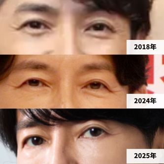 2018年・2024年・2025年の藤木直人さんの目元の比較画像