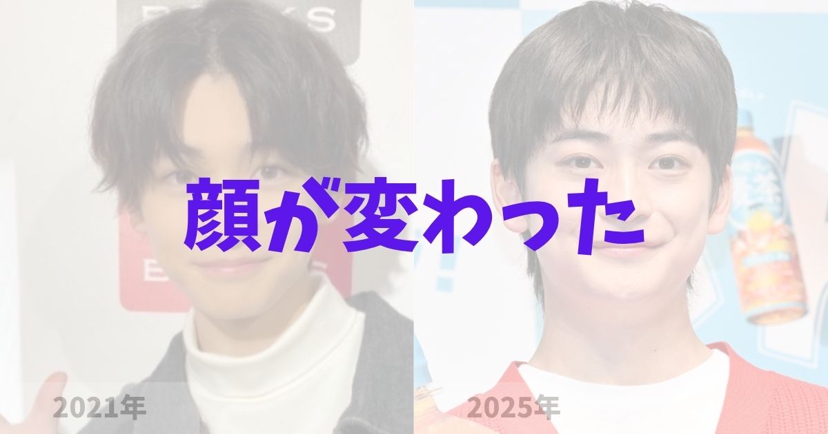 高橋文哉の顔が変わった！整形かバセドウ病か？の記事