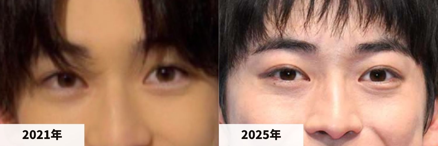 2021年と2025年の高橋文哉さんの目元の比較画像
