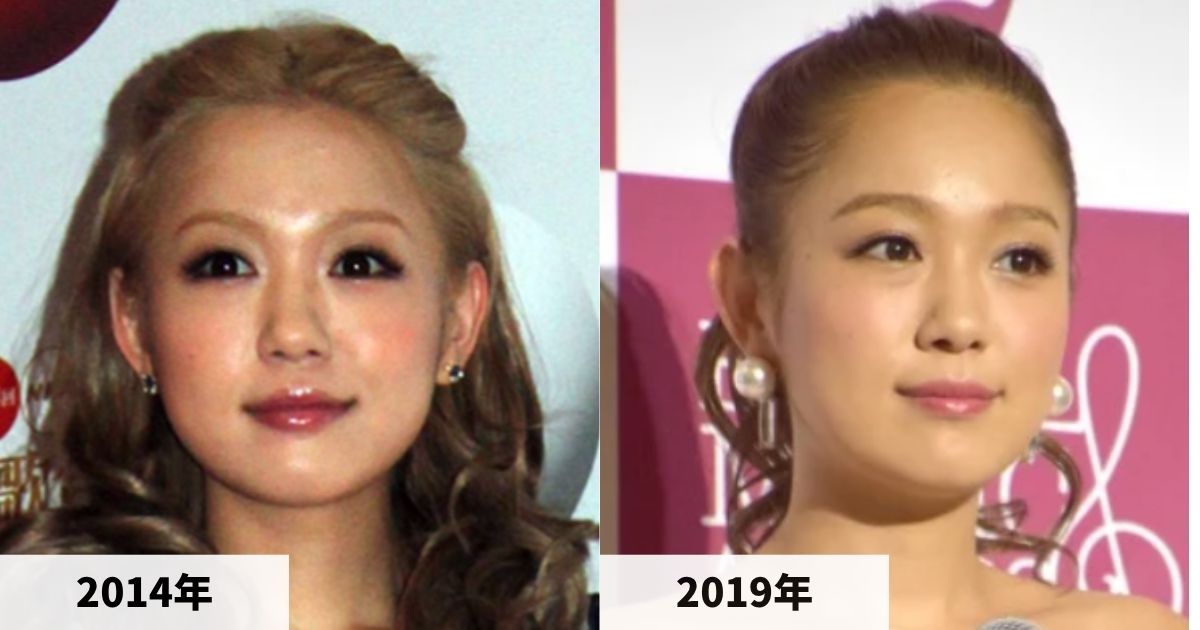 2014年と2019年の西野カナの顔の比較画像