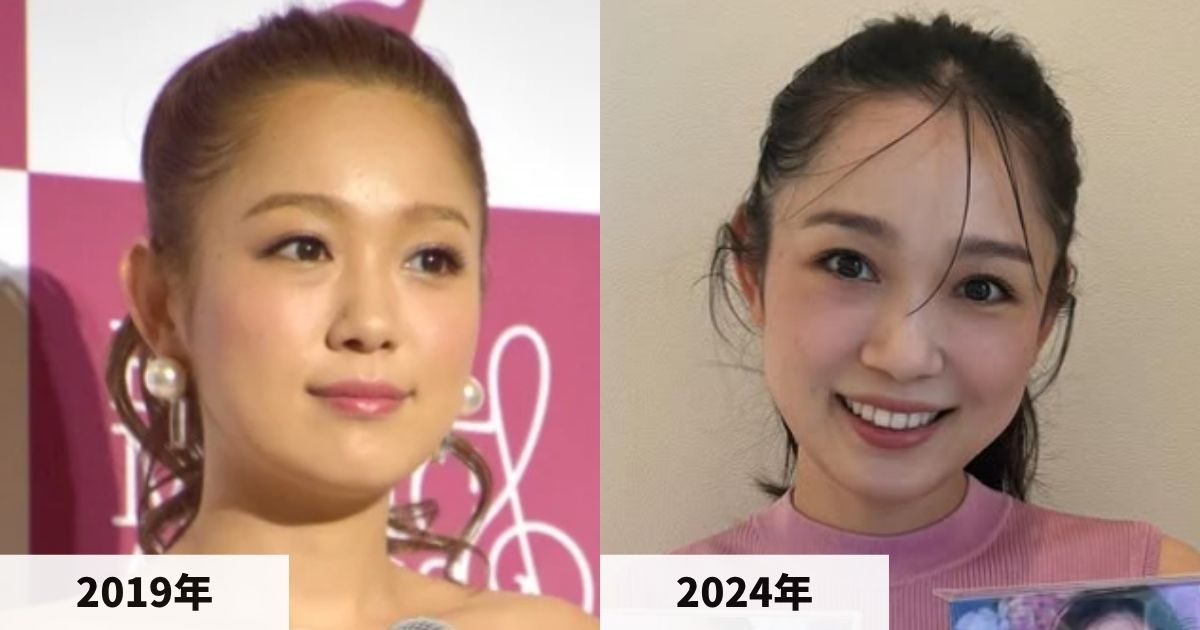 2019年と2024年の西野カナの顔の比較画像