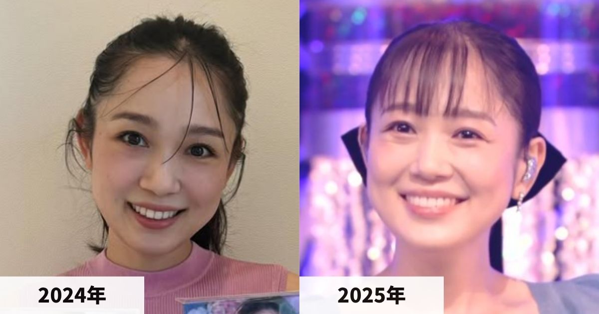 2024年と2025年の西野カナの顔の比較画像