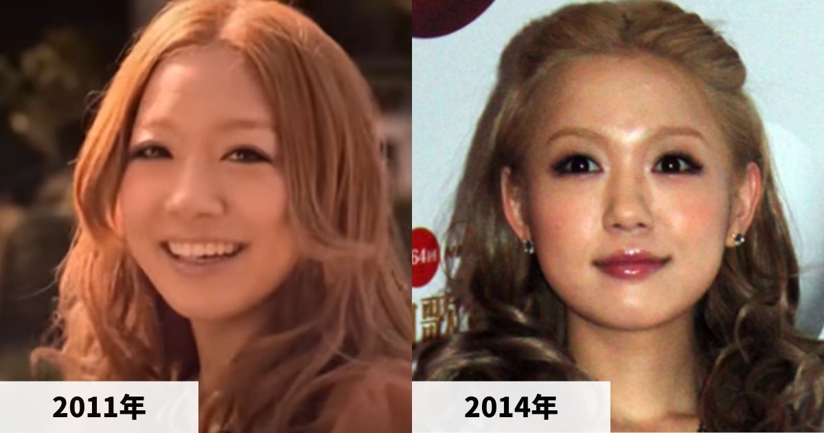 2011年と2014年の西野カナの顔の比較画像