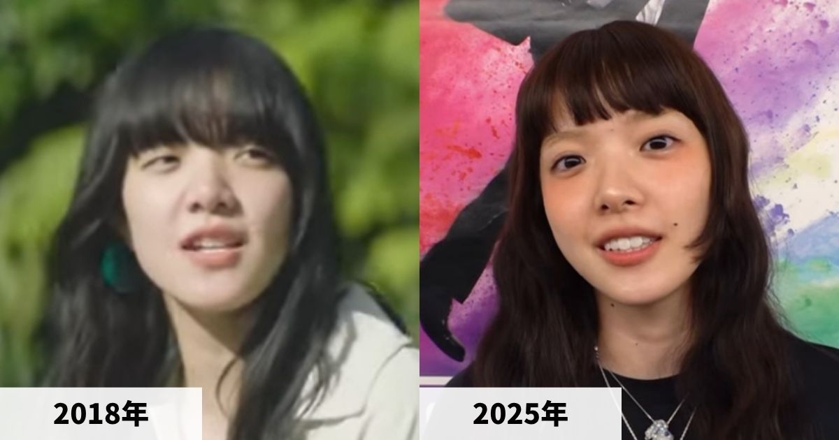 2018年と2025年のあいみょんさんの顔の比較画像