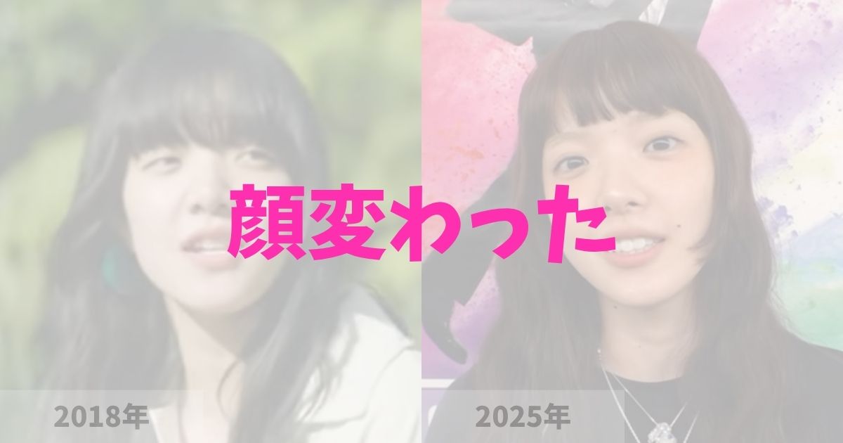 あいみょんの顔が変わったのは整形？の記事