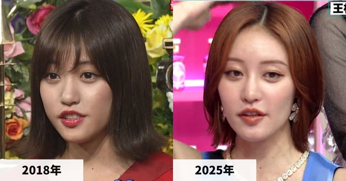 2018年と2025年の王林さんの唇の比較画像