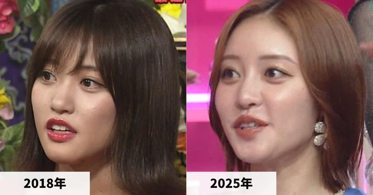 2018年と2025年の王林さんの鼻の比較画像
