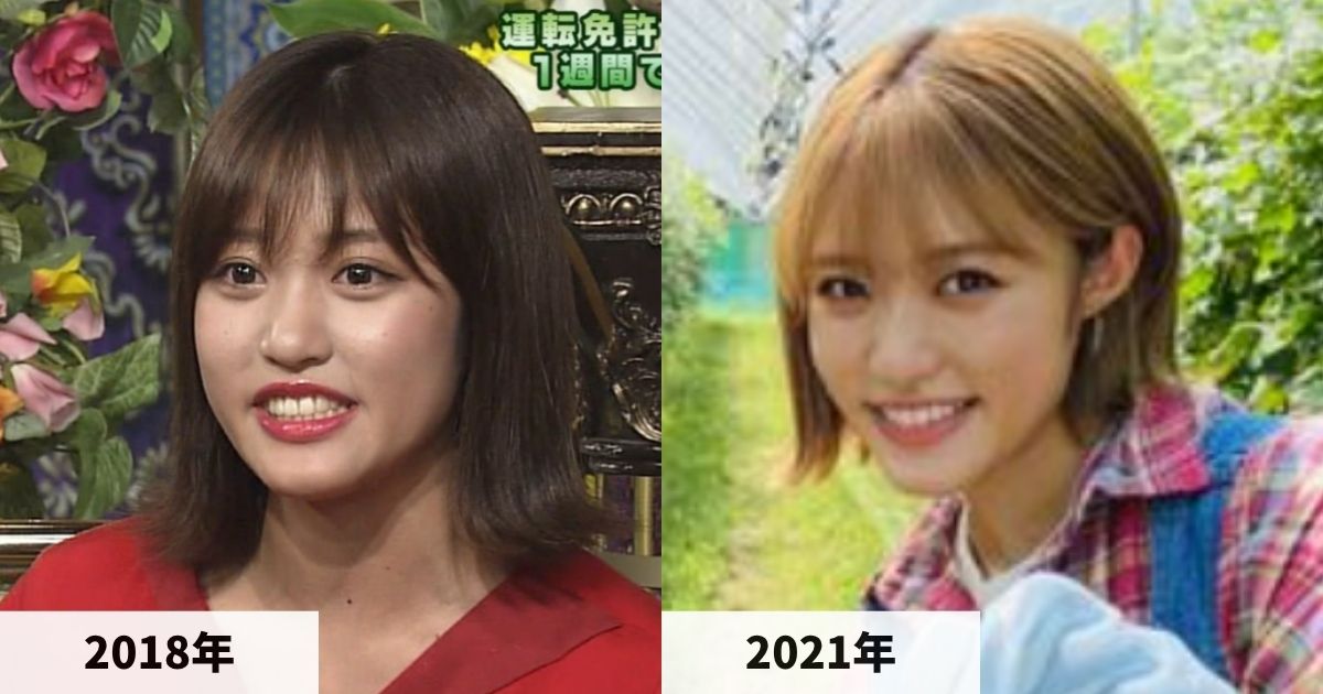 2018年と2021年の王林さんの顔の比較画像