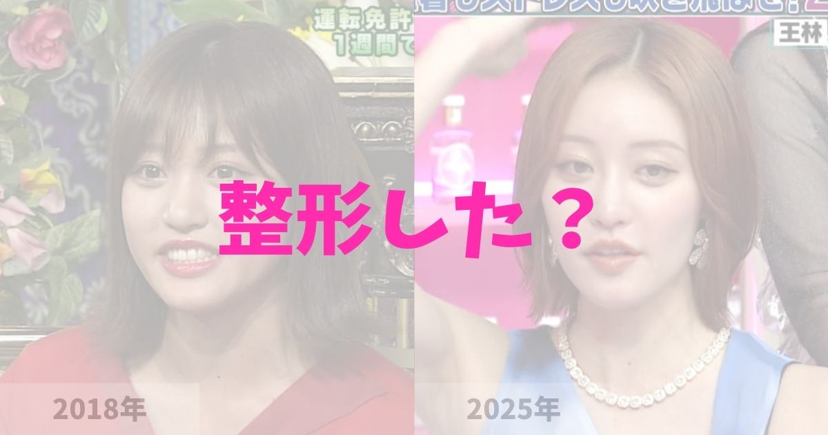 王林は整形した？の記事