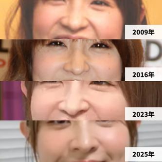 2009年・2016年・2023年・2025年の大沢あかねさんの鼻の比較画像