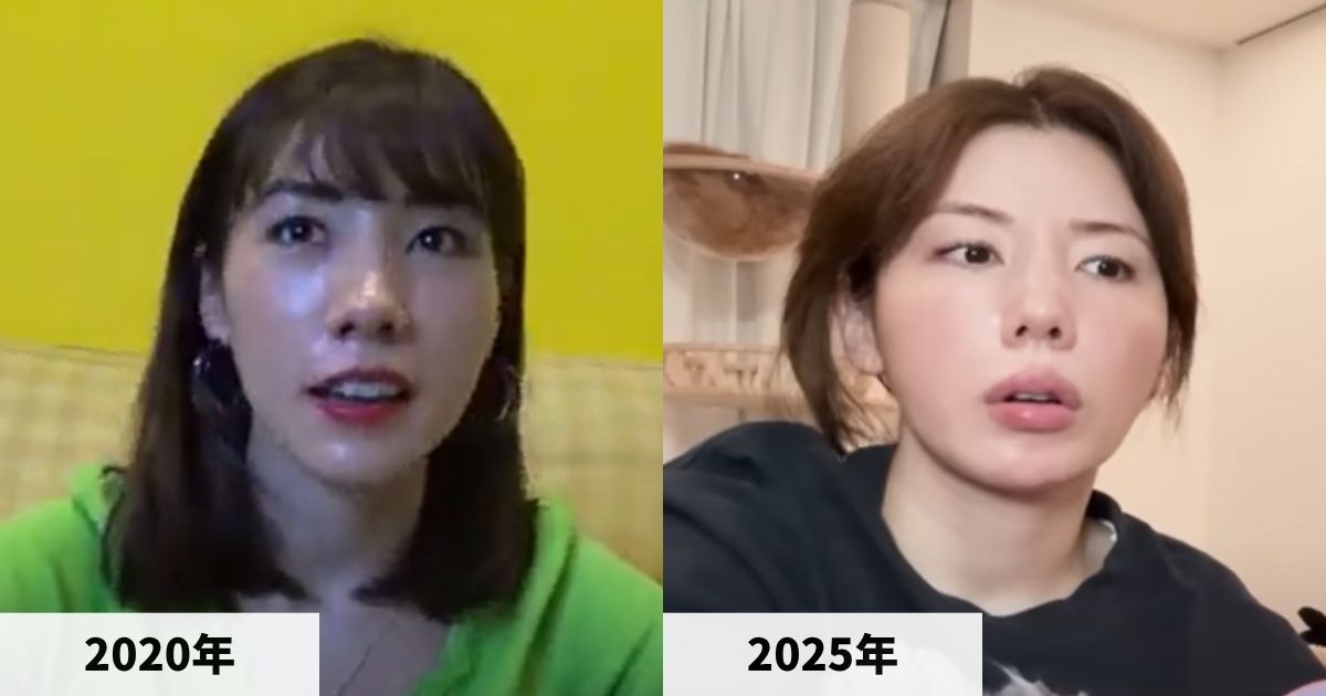 2020年と2025年の仲里依紗さんの顔の比較画像