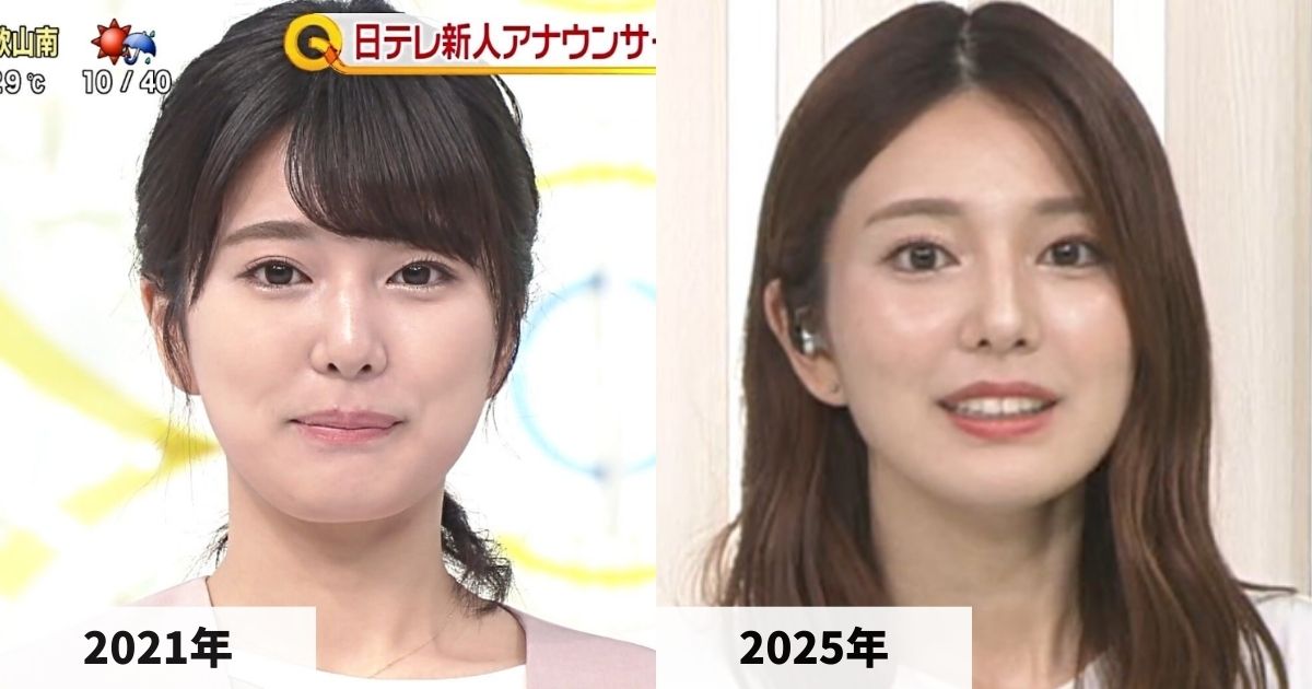 2021年と2025年の黒田みゆアナの鼻の比較画像