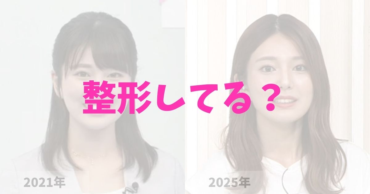 日テレの黒田みゆアナは整形してる？の記事
