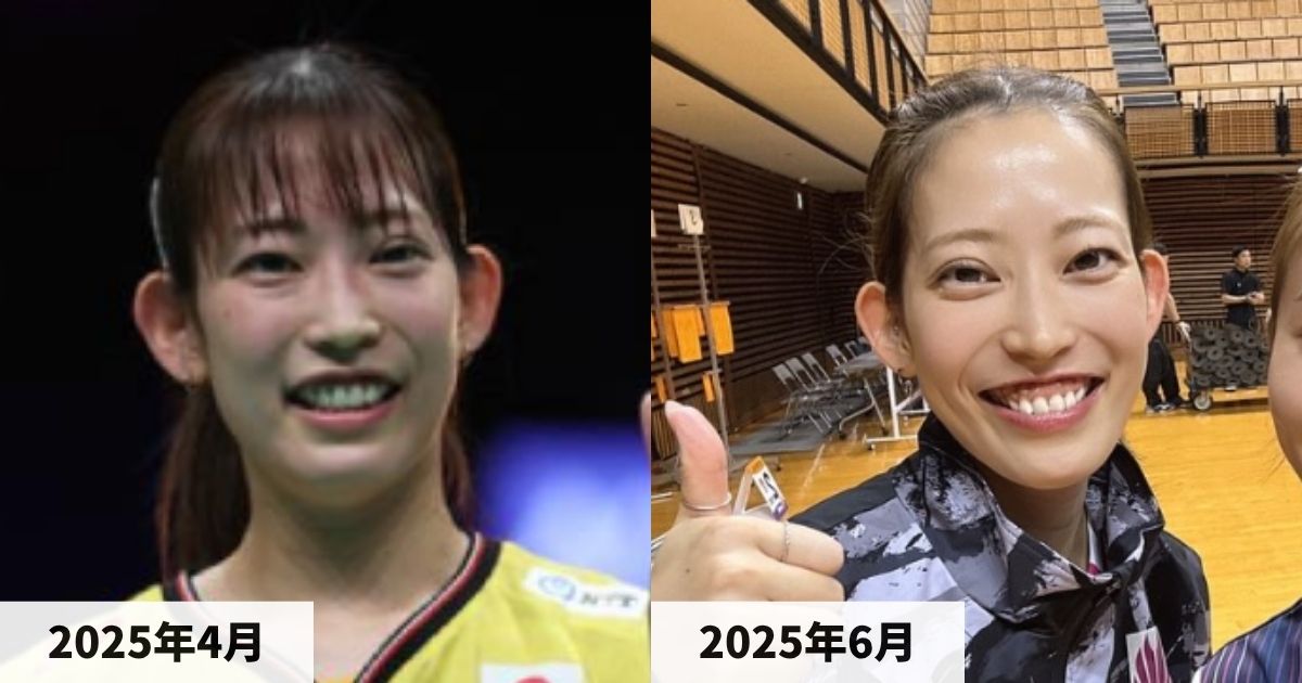 2025年4月と2025年6月の松山奈未選手の顔の比較画像