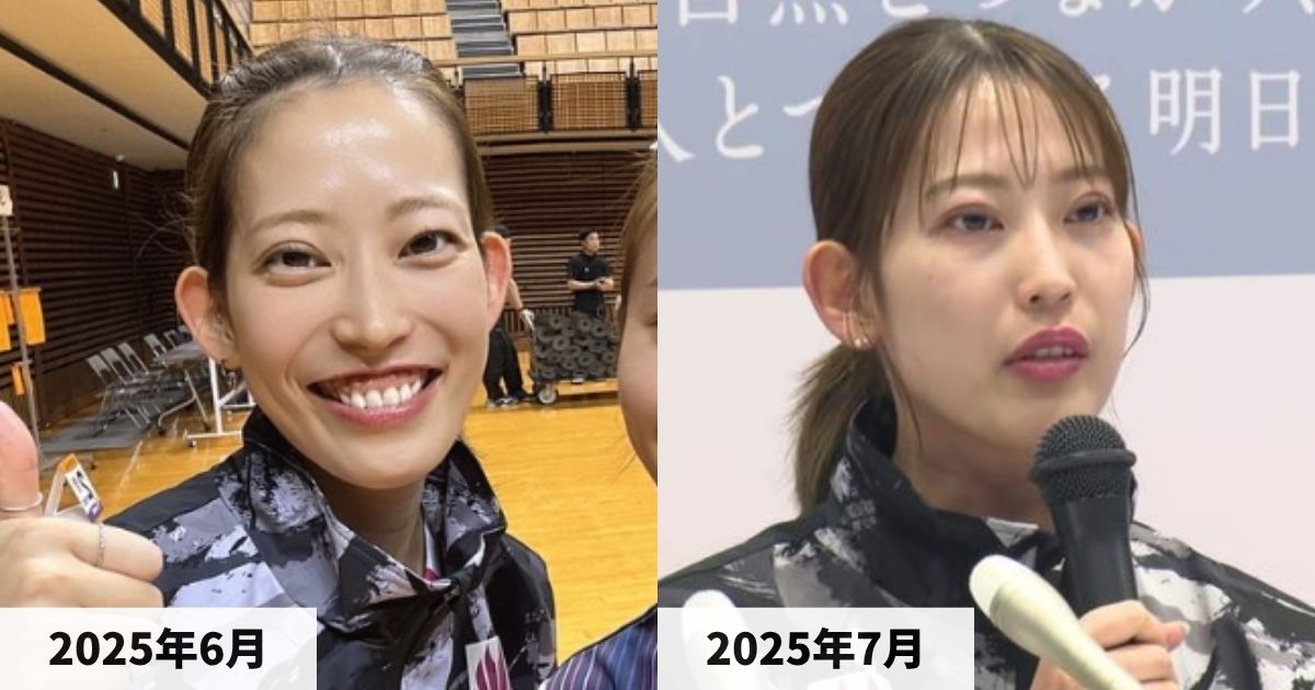 2025年6月と2025年7月の松山奈未選手の顔の比較画像