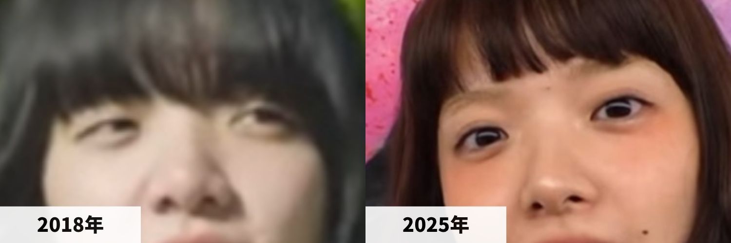 2018年と2025年のあいみょんさんの目元の比較画像