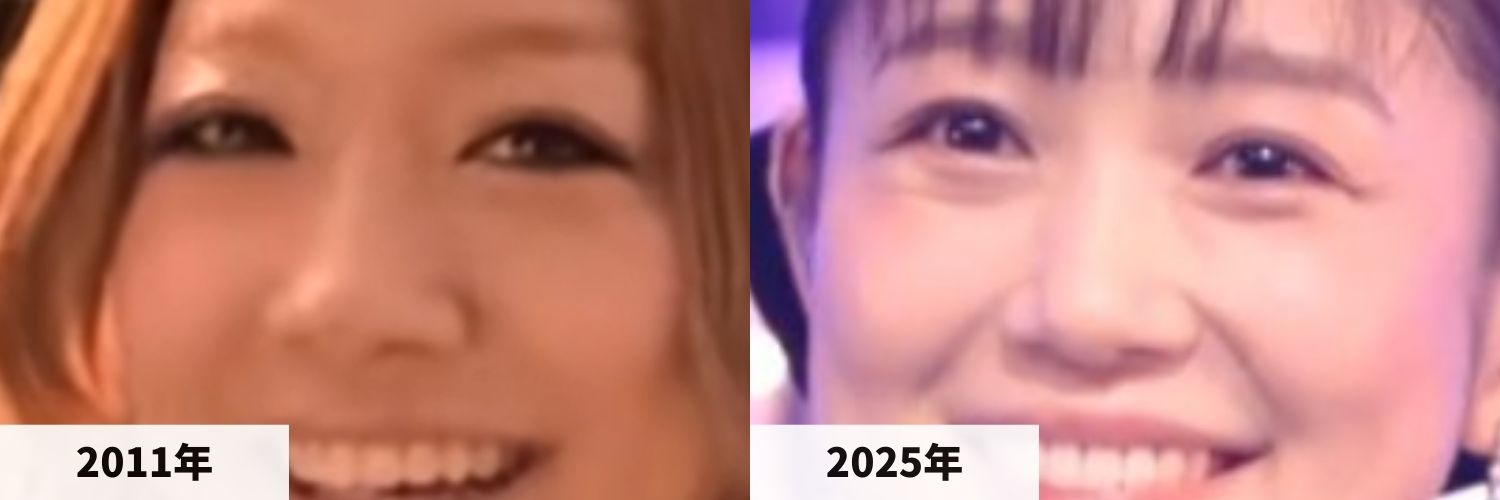 2011年と2025年の西野カナさんの鼻の比較画像