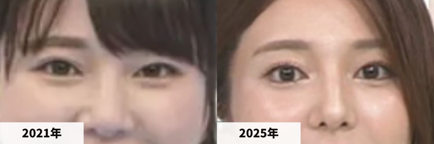 2021年と2025年の黒田みゆアナの目元の比較画像