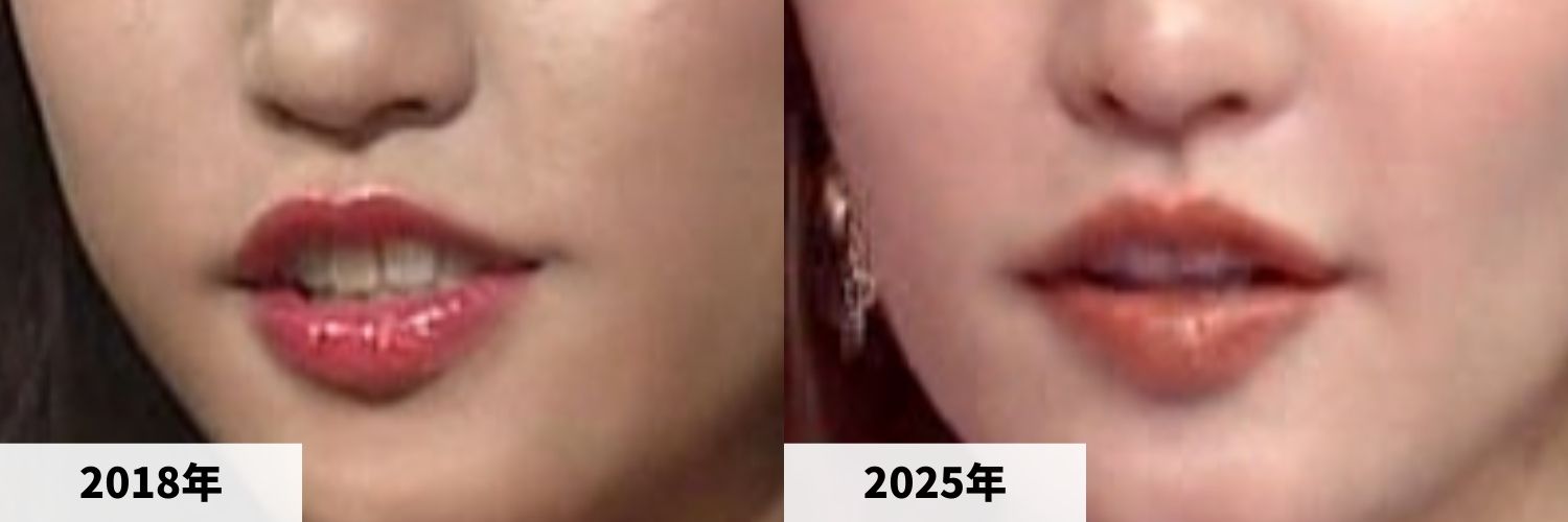2018年と2025年の王林さんの唇の比較画像