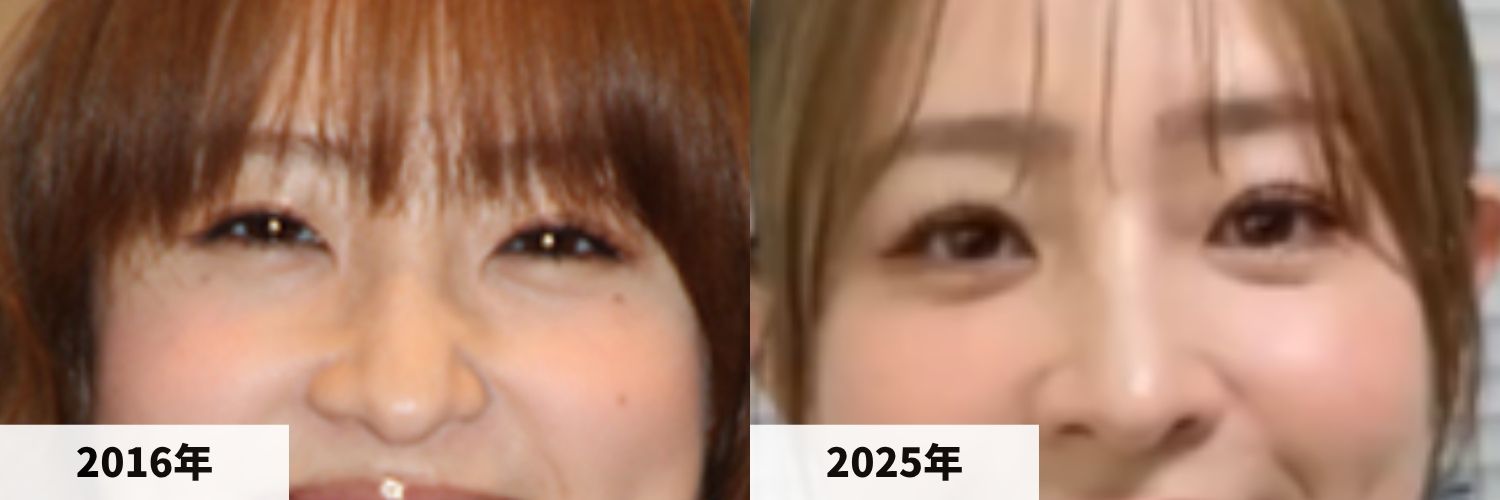 2016年と2025年の大沢あかねさんの目元の比較画像