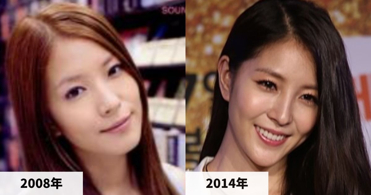 2008年と2014年のBoAの顔の比較画像