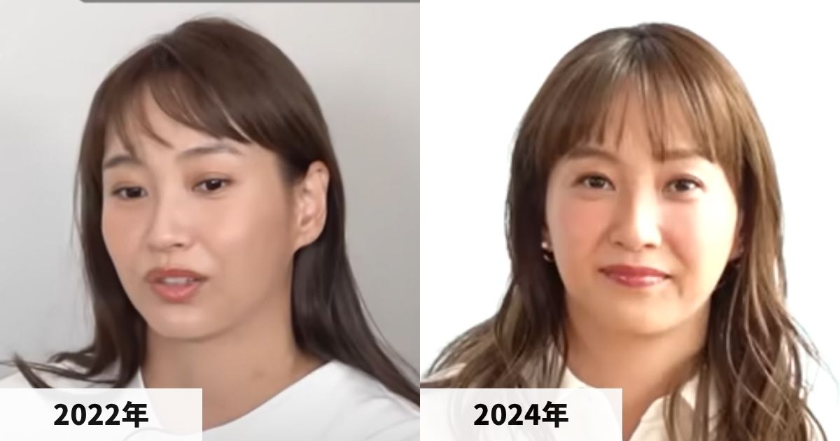 2022年と2024年の藤本美貴さんの顔の比較画像