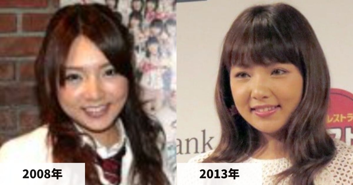 2008年と2013年の野呂佳代さんの顔の比較画像