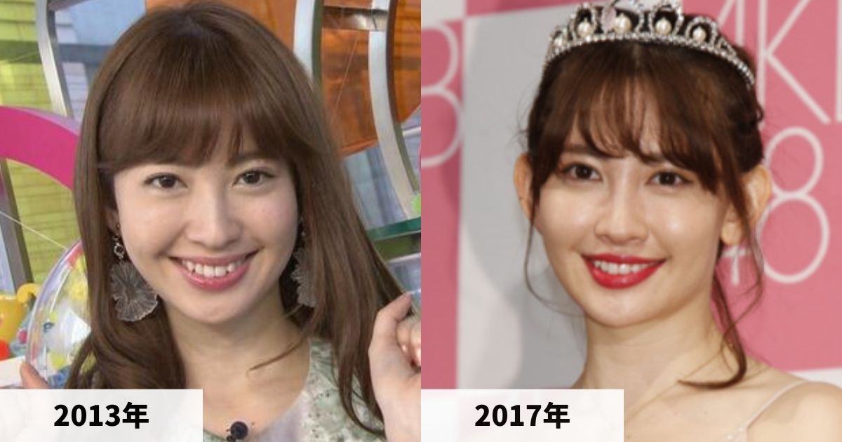 2013年と2017年の小嶋陽菜さんの顔の比較画像