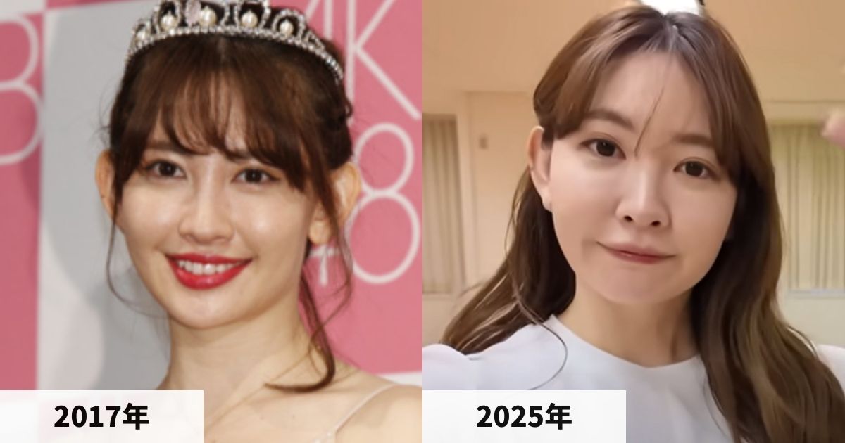 2017年と2025年の小嶋陽菜さんの顔の比較画像