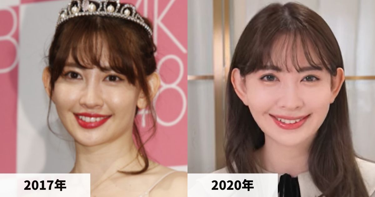 2017年と2020年の小嶋陽菜さんの顔の比較画像