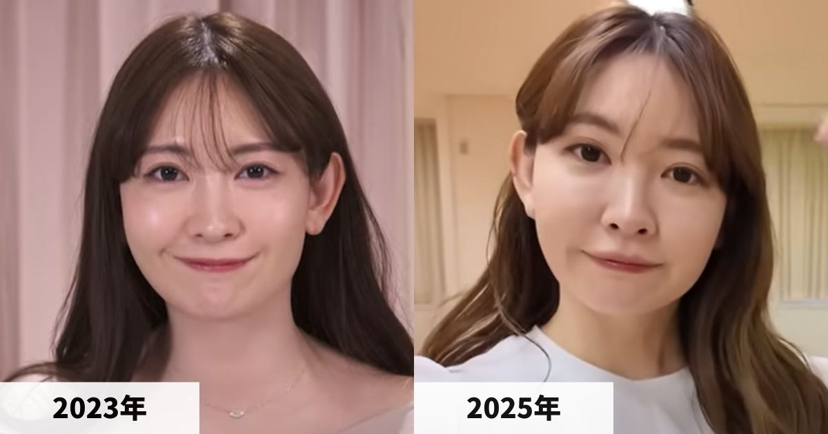 2023年と2025年の小嶋陽菜さんの顔の比較画像
