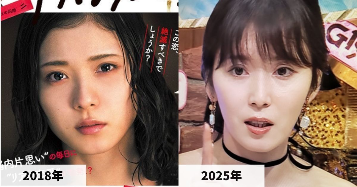 2018年と2025年の松岡茉優さんの唇の比較画像